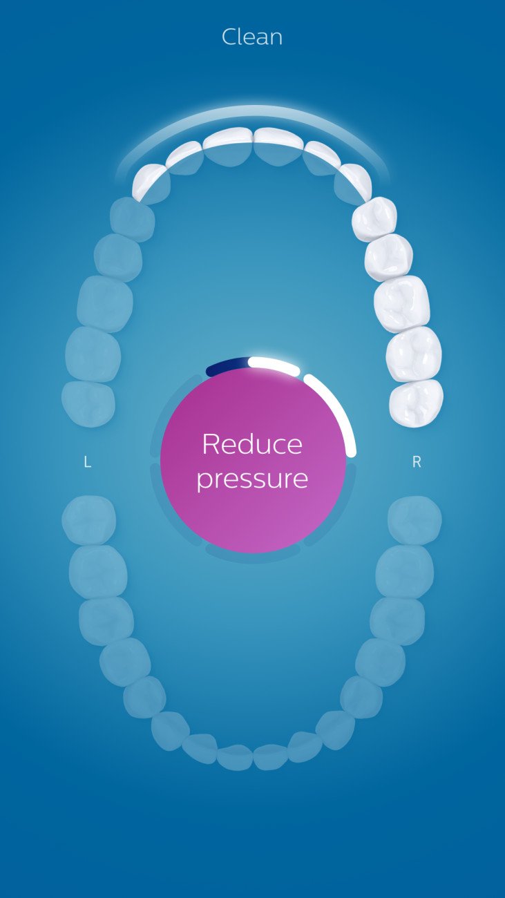 Philips Sonicare - DiamondClean Smart 9300 Rechargeable Toothbrush