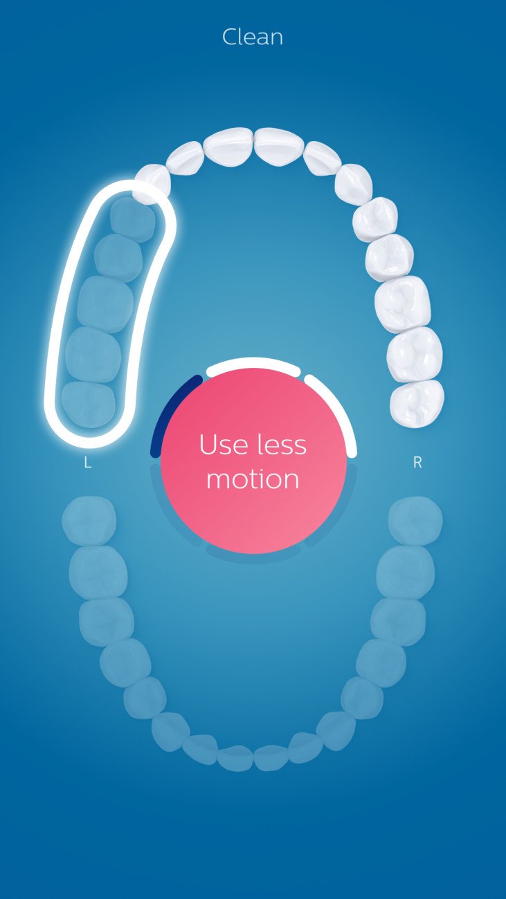 Philips Sonicare - DiamondClean Smart 9300 Rechargeable Toothbrush