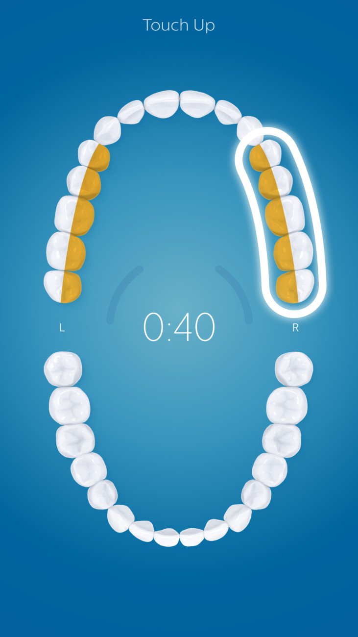 Philips Sonicare - DiamondClean Smart 9300 Rechargeable Toothbrush