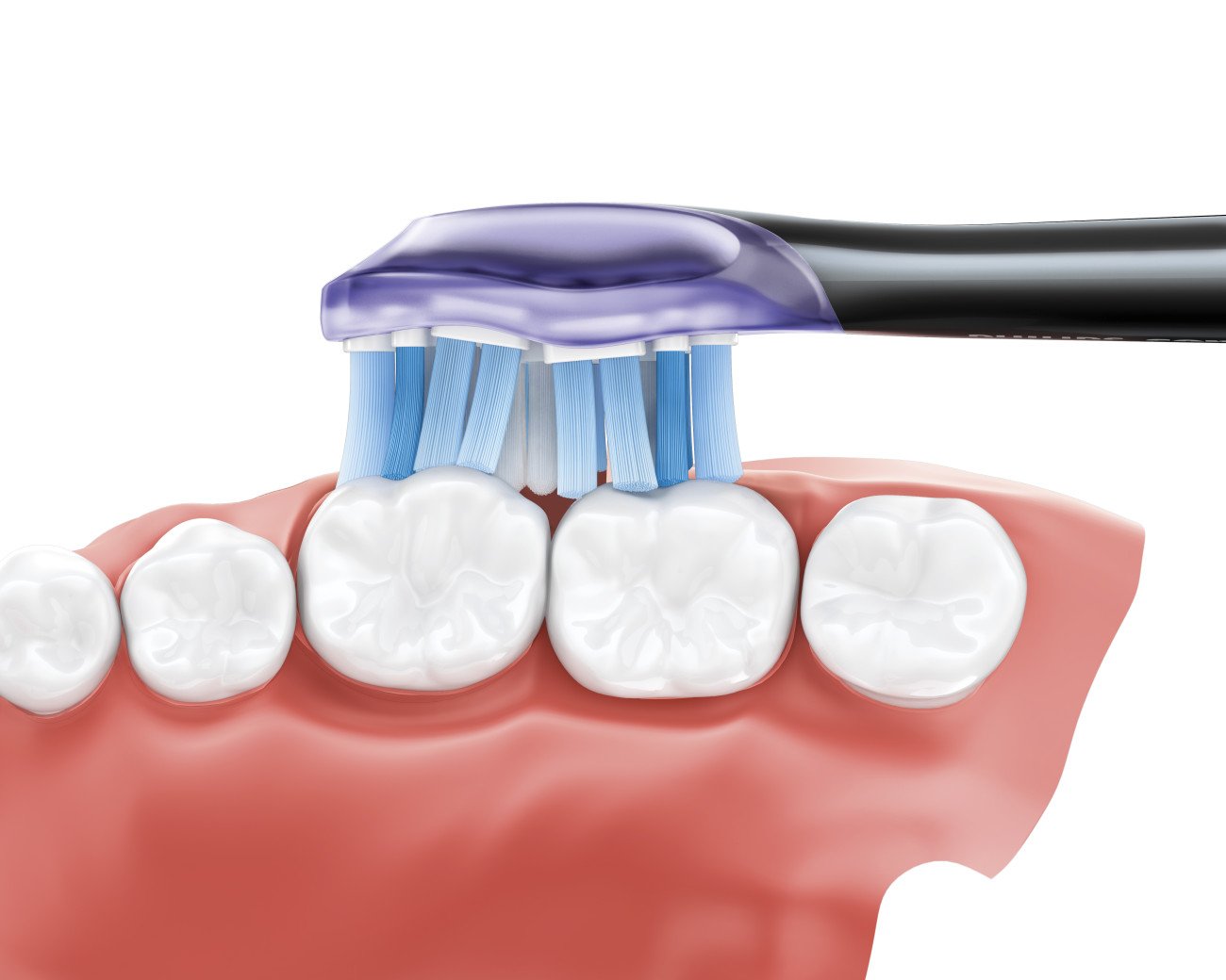 Philips Sonicare - DiamondClean Smart 9300 Rechargeable Toothbrush