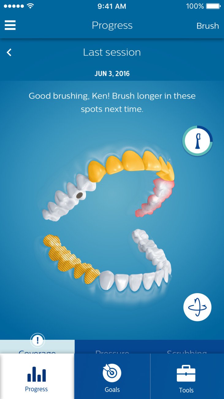 Philips Sonicare - DiamondClean Smart 9300 Rechargeable Toothbrush