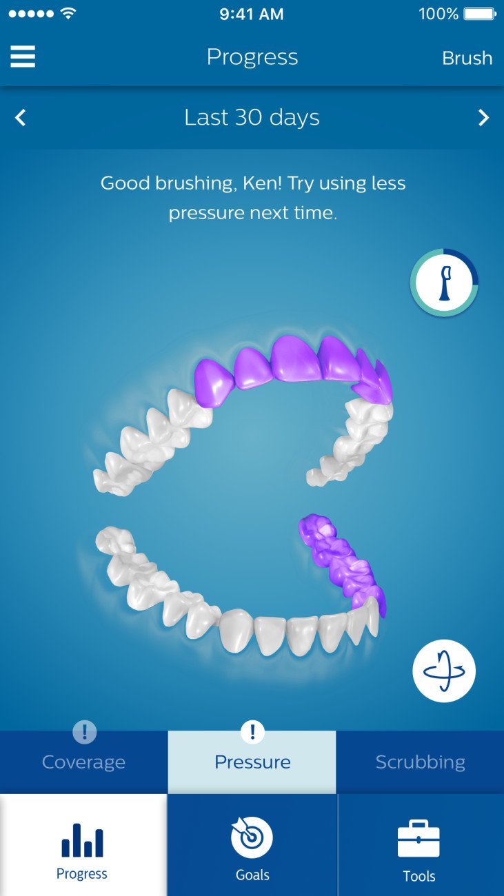 Philips Sonicare - DiamondClean Smart 9300 Rechargeable Toothbrush