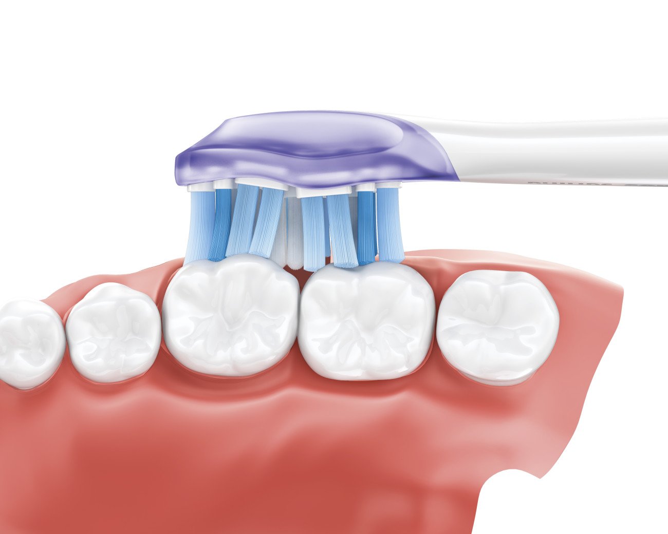 Philips Sonicare - DiamondClean Smart 9300 Rechargeable Toothbrush