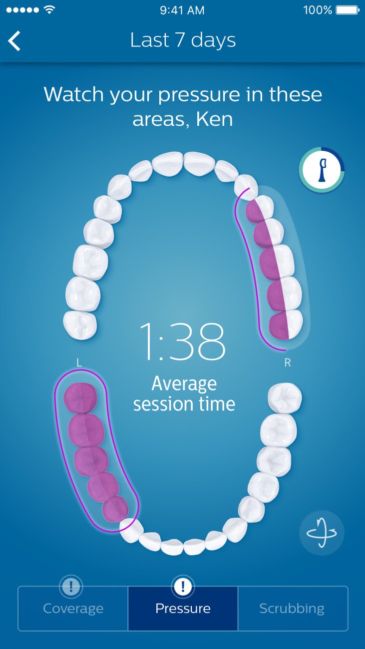 Philips Sonicare - DiamondClean Smart 9300 Rechargeable Toothbrush